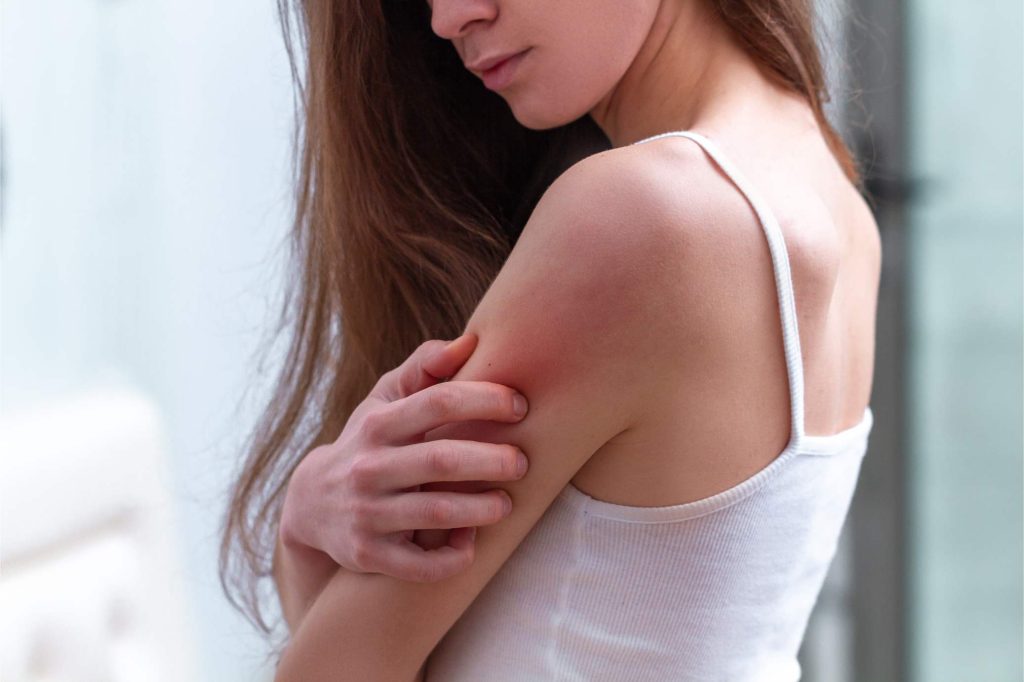 Pielea uscată: tot ce trebuie să știi despre această afecțiune dermatologică