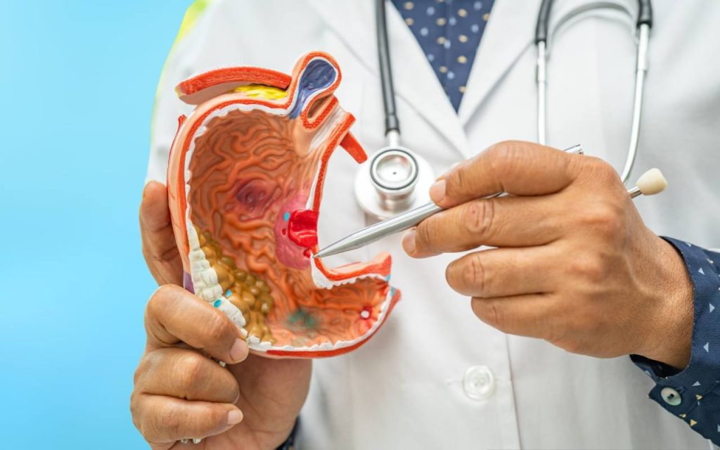 Digestia lentă și tranzitul intestinal lent: cauze, simptome și soluții eficiente