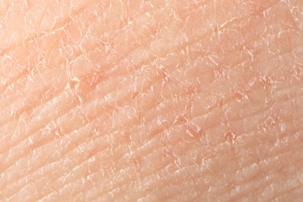 Vitamine pentru pielea uscată – îngrijirea începe din farfurie