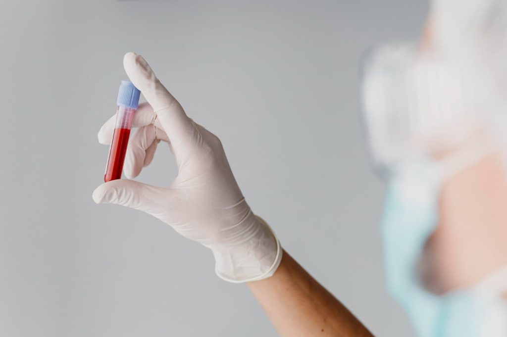 CRP cantitativ crescut: cauze și ce înseamnă o proteina C reactivă mare