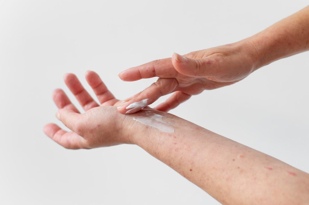 Psoriazis gutat: semne timpurii, cauze ascunse și soluții eficiente pentru piele sănătoasă