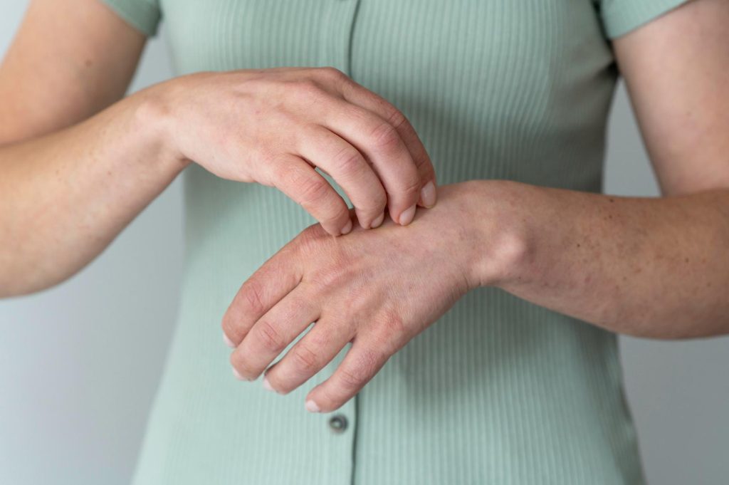 Ce boli ascunde mâncărimea de piele? Psoriazis, dermatită atopică, urticarie și alte afecțiuni cutanate