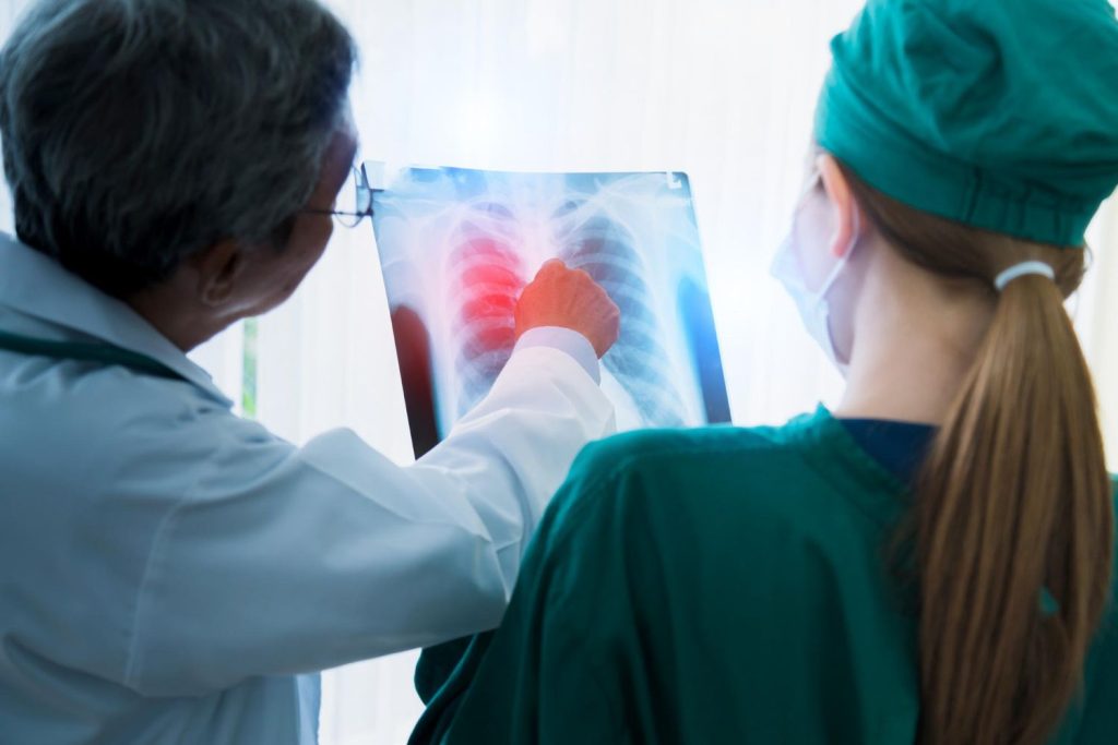 Abcesul pulmonar: Cauze, simptome și tratament pentru supurație și infecția pulmonară cu puroi la plămâni