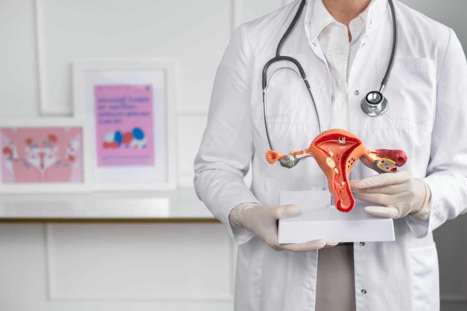 1. torsiunea ovariana doctor, model anatomic sistem reproducator