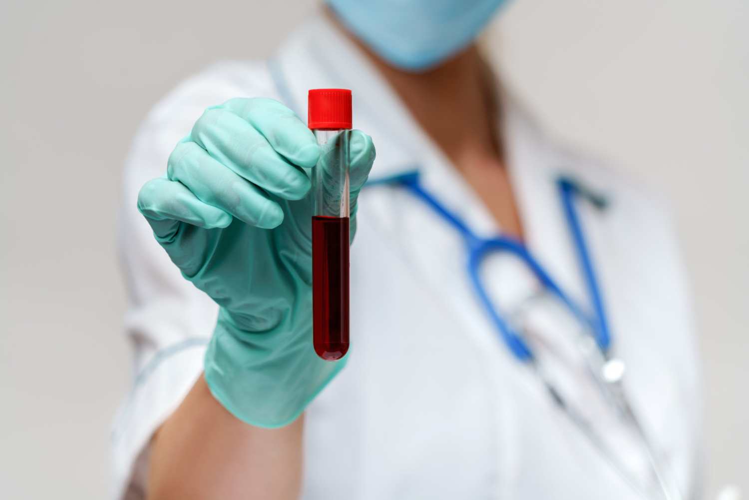 1. eozinofilie test de sange