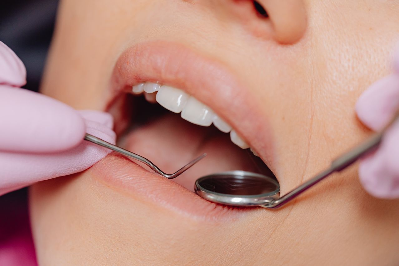 Chist dentar ce arata radiografia, cand se trateaza si cum sustii recuperarea