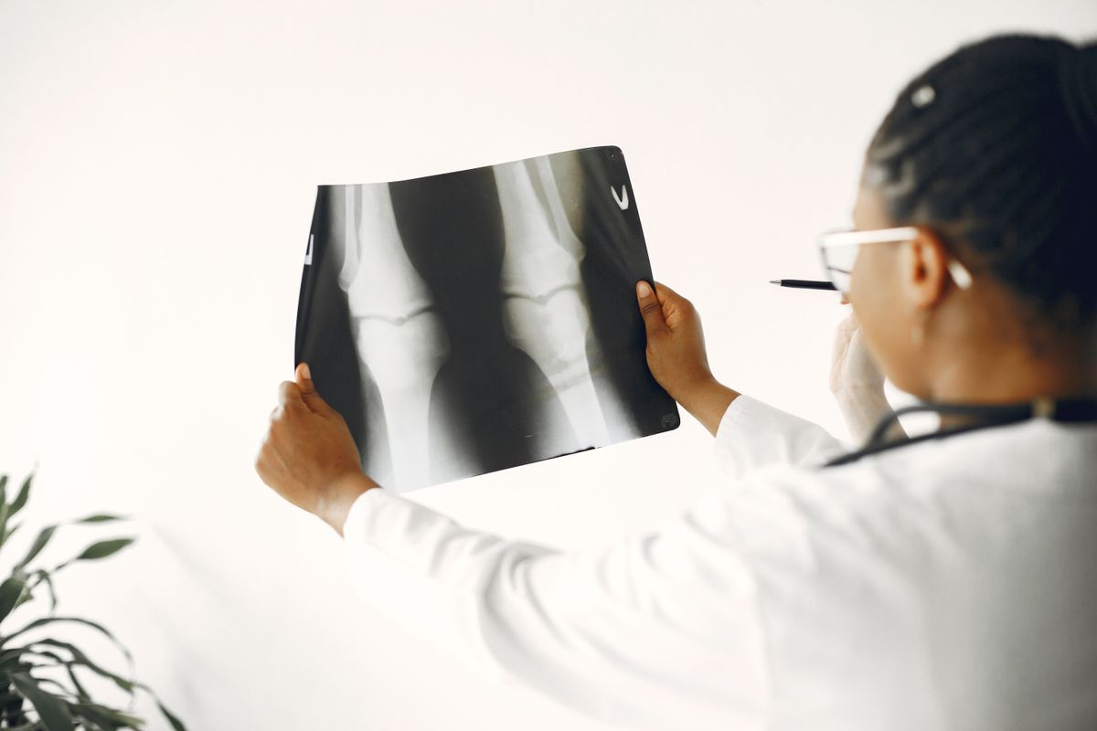 Chistul osos (medic ortoped care verifica o radiografie, zona genunchilor, halat medical alb)