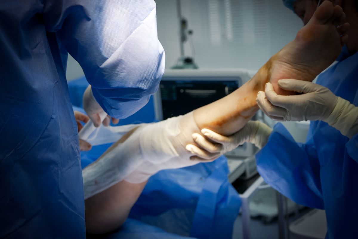 Fractura deschisa (medici care opereaza piciorul unui pacient, fractura deschisa la picior, halate chirurgicale albastre)